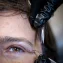 Under-skin implant lets users directly control prosthetic arms